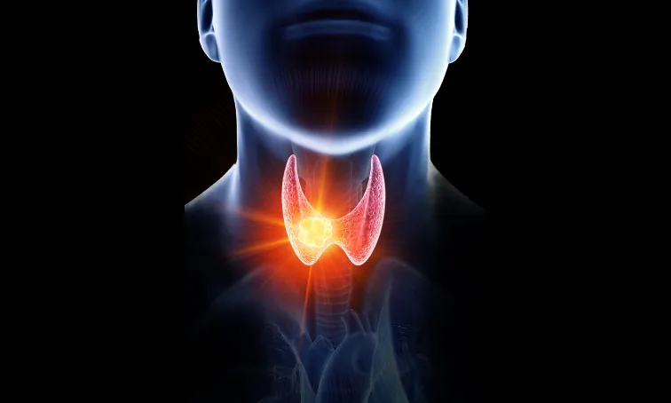 Hipotiroidi görseli